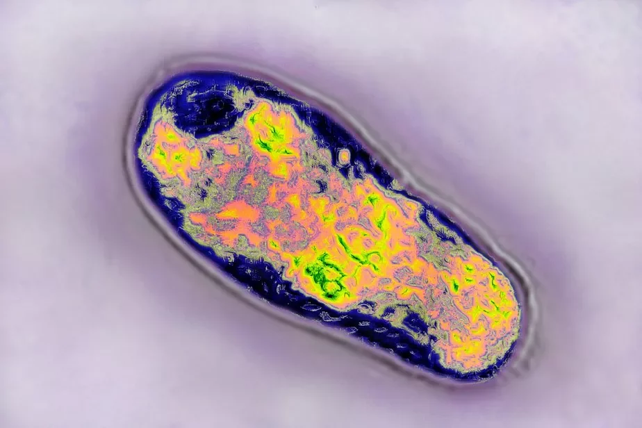 Bakteryjalnaja infiekcyja Brucella, jakaja zvyčajna nazirajecca ŭ žyvioł i vyklikaje ŭ ich biaspłodździe. Fota: BSIP / Contributor Getty Images